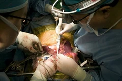 Ảnh minh họa. (Nguồn: Getty images)