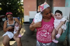 Cặp song sinh bị dị tật đầu nhỏ do mẹ bị nhiễm virus Zika tại Areia, bang Paraiba, Brazil. (Ảnh: AFP/TTXVN)