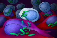 Nhóm các nhà khoa học tại WIS đã tìm thấy vi khuẩn trong các tế bào của tất cả các loại ung thư. (Nguồn: twitter.com)