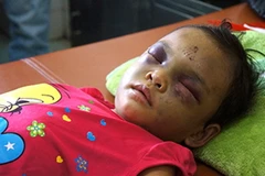 Xác nhận nghi phạm đánh trẻ chấn thương sọ não là cha mẹ ruột