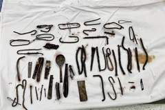 Hàng chục mảnh kim loại được lấy ra từ dạ dày của bệnh nhân. (Ảnh: TTXVN phát)