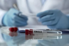 Mỹ siết chặt quy định với người nhập cảnh từ Uganda nhằm ngăn Ebola