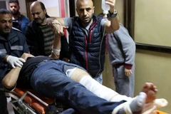 Phóng viên Rashed Rashid của hãng AP trúng đạn. (Nguồn: AP)