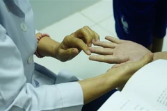 Khám bệnh cho trẻ em có dấu hiệu mắc bệnh tay chân miệng. (Ảnh: Đinh Hằng/TTXVN)