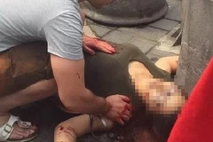 Người phụ nữ bị thương nặng ở vùng ngực và bụng. (Nguồn: CCTV)