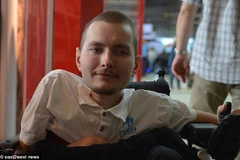 Valery Spiridonov tình nguyện tham gia ca ghép đầu người đầu tiên trên thế giới. (Ảnh: dailymail.co.uk)