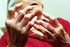 Ảnh minh họa. (Nguồn: Internet)