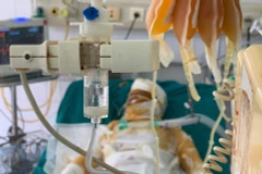 Một nạn nhân trong thảm án tẩm xăng, đốt nhà đang được điều trị với vết thương rất nặng. (Ảnh: PV/Vietnam+) 