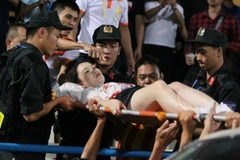 Nữ cổ động viên bị bắn pháo sáng trúng chân. (Ảnh: Vietnam+) 