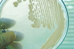 Nấm Candida auris. (Nguồn: Sciencealert)
