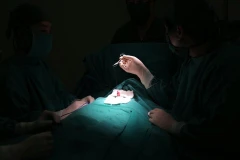 Các bác sỹ bệnh viện đa khoa Đức Giang đang thực hiện ca phẫu thuật lún dương vật ở trẻ nhỏ. (Nguồn: TTXVN)