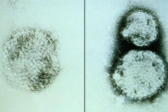 Virus Hanta. (Nguồn: El Comercio)