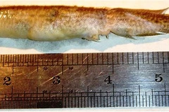 Cậu bé suýt mất mạng vị bị con lươn dài 16cm chui vào cổ họng