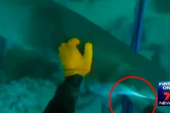 Chàng trai 17 tuổi may mắn thoát chết khi bị cá mập cắn vào tay