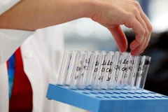 Ảnh minh họa. (Nguồn: Getty Images)