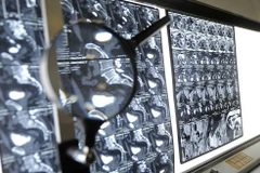 Phim chụp của một bệnh nhân ung thư. (Nguồn: TASS)