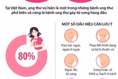 [Infographics] Đẩy lùi ung thư vú thông qua sàng lọc và phát hiện sớm