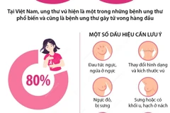 [Infographics] Đẩy lùi ung thư vú thông qua sàng lọc và phát hiện sớm