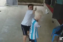 Hà Nội: Điều tra, xác minh vụ việc một cháu bé bị hành hung