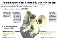 Ra mắt trái tim nhân tạo hoàn chỉnh đầu tiên trên thế giới