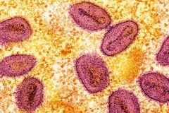 Virus đậu mùa khỉ. (Ảnh: Reuters)