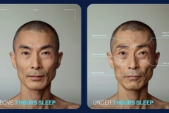 Hình ảnh AI mô phỏng diện mạo của một người khi ngủ đủ 7 giờ mỗi đêm (trái) và khi bị thiếu ngủ (phải). (Nguồn: Simba Sleep)