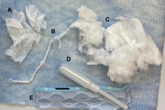 Các nhà nghiên cứu phát hiện 16 kim loại có trong băng vệ sinh tampon. (Ảnh: UC Berkeley)