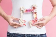 Đáng lo ngại xu hướng người trưởng thành Canada mắc ung thư trực tràng