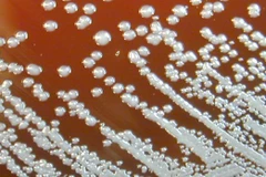 Đắk Nông lần đầu ghi nhận trường hợp mắc bệnh Whitmore