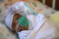 Cô gái bé nhỏ nhất thế giới Saybie. (Nguồn: cbsnews.com)