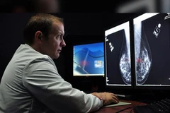 Trí tuệ nhân tạo có thể chẩn đoán ung thư não chính xác hơn chuyên gia. (Nguồn: wqad.com)