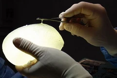 Túi ngực PIP. (Nguồn: Reuters)