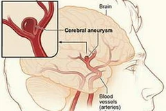 Ảnh minh họa. (Nguồn: Internet)