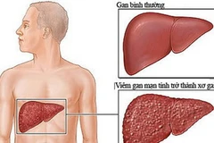 Ảnh minh họa. (Nguồn: Medelab.vn)