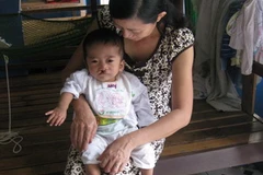 Bệnh nhi Văn Chi Hương được bác sỹ Godefroy De Miscault phẫu thuật năm 2011. (Ảnh TL./Vietnam+)