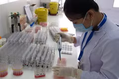  Sàng lọc máu tại Ngân hàng tế bào gốc của Bệnh viện Truyền máu-Huyết học Thành phố Hồ Chí Minh. (Ảnh: Phương Vy/TTXVN)