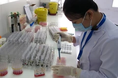  Sàng lọc máu tại Ngân hàng tế bào gốc của Bệnh viện Truyền máu-Huyết học Thành phố Hồ Chí Minh. (Ảnh: Phương Vy/TTXVN)