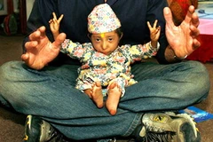 Người tý hon Khagendra Thapa Magar. (Ảnh: TT&VH)