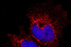 Phát hiện phân tử protein làm thay đổi cấu trúc tế bào ung thư vú