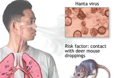 (Nguồn: medlineplus.gov)