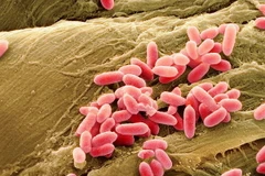 Ảnh minh họa. (Nguồn: Pinterest)