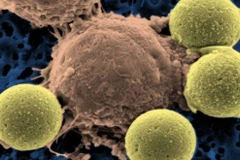 Công bố liệu pháp đột phá trong việc điều trị ung thư