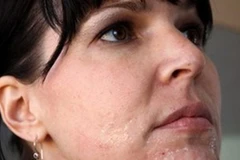 Những mẹo hay và dễ làm giúp bạn thu nhỏ lỗ chân lông