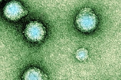Samoa: Gần 100 người dân mắc bệnh từ một loại virus lạ