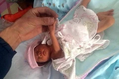 Trung Quốc: Bé gái sinh non sống sót sau 2 giờ bị chôn sống