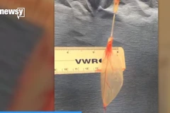 [Video] Khoa học kỳ diệu: Nuôi cấy thành công mô tim từ rau cải bó xôi