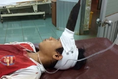 Bệnh nhân Tùng nhập viện cấp cứu trong tình trạng tỉnh táo. (Ảnh: Hưng Thịnh/Vietnam+)