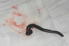 Ảnh chỉ có tính minh họa. (Nguồn: Internet)