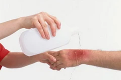 Ảnh chỉ có tính minh họa. (Nguồn: Internet)