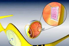 Ảnh chỉ có tính minh họa. (Nguồn: Internet)